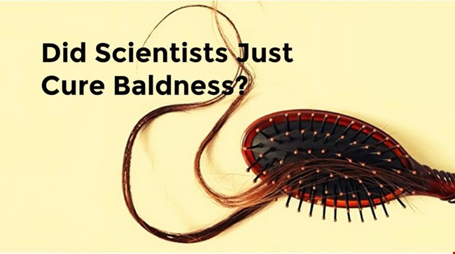 Did Scientists Just Cure Baldness?